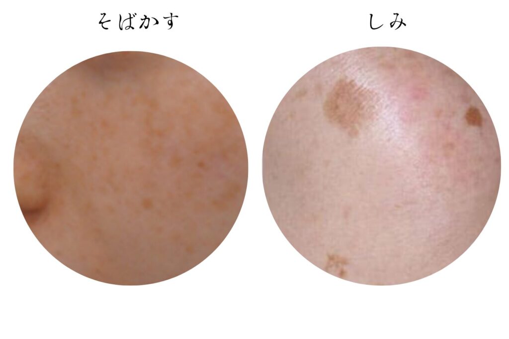 大きさ・色・形の違い