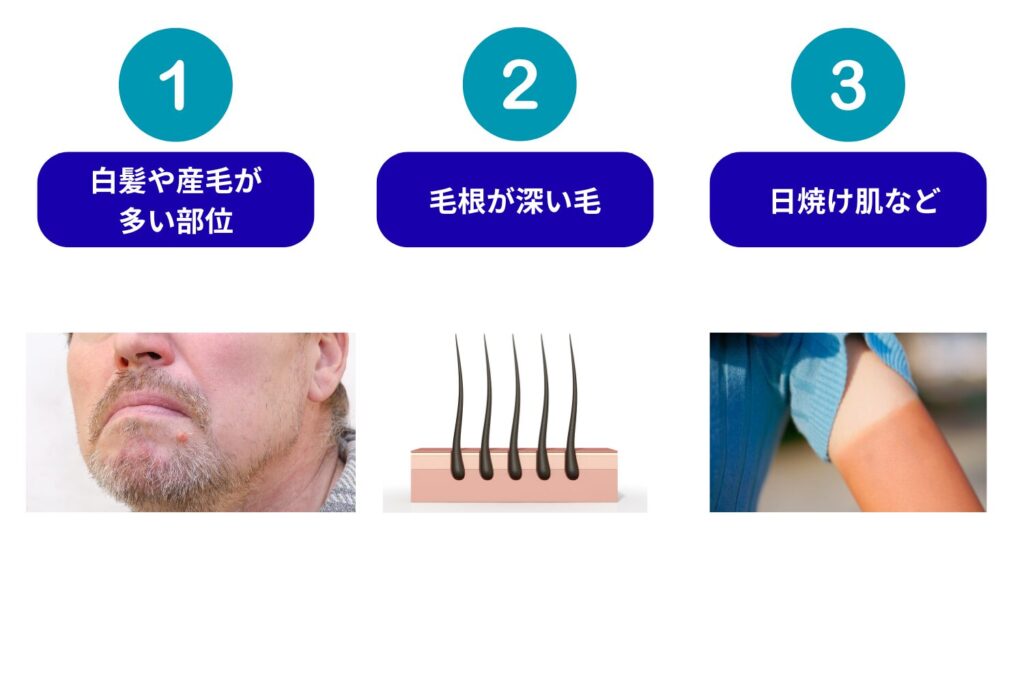 医療脱毛1回で効果を感じにくい部位