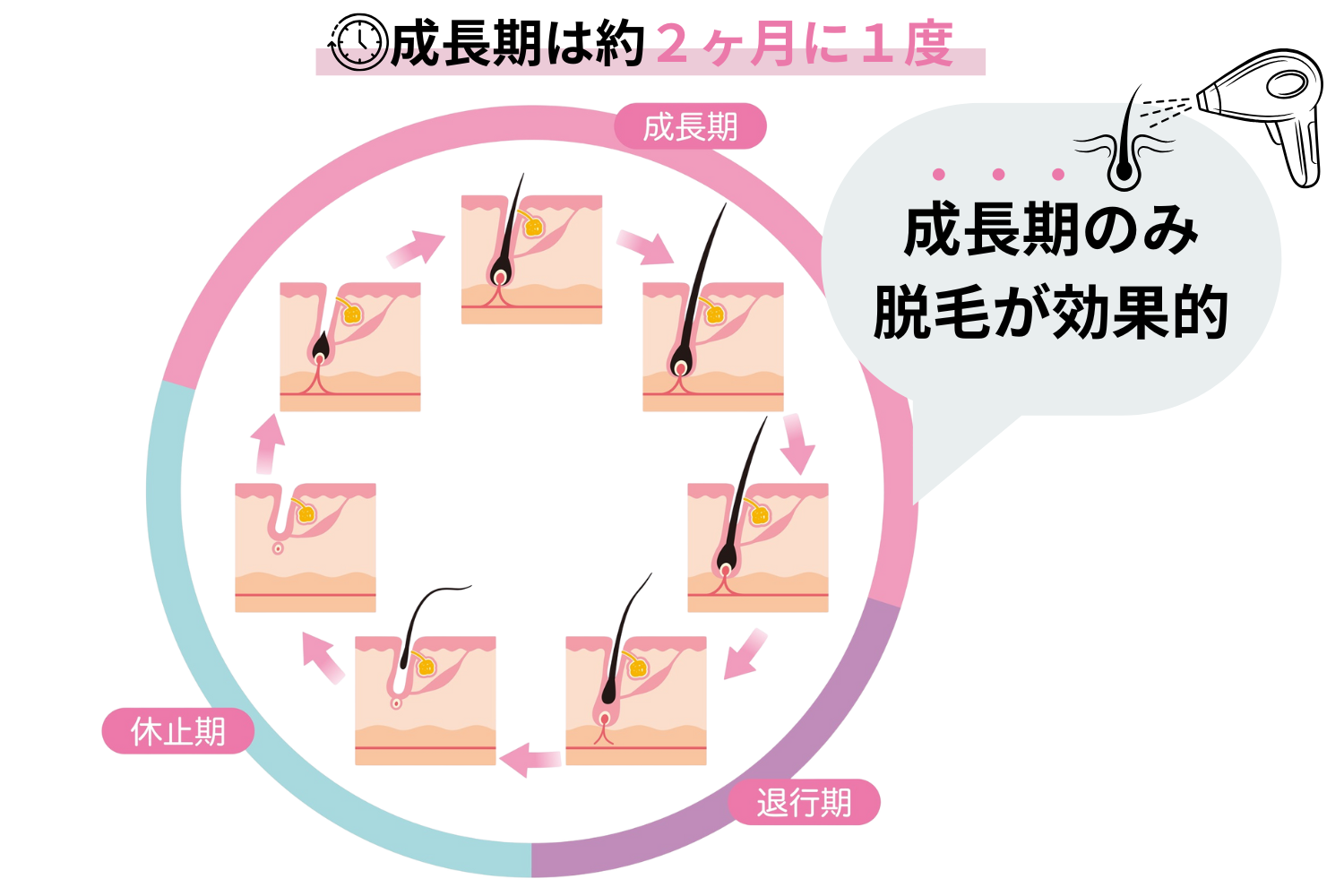 脱毛は毛周期にあわせた脱毛をしないと効果はない