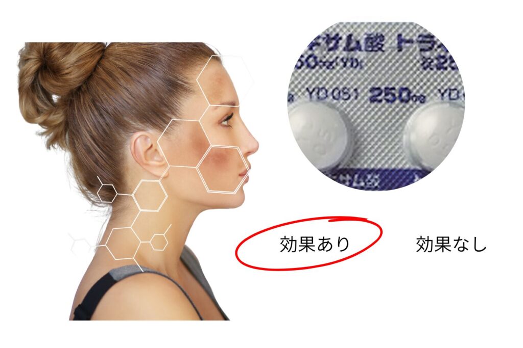 トラネキサム酸とは？基本的な特徴と美容医療での役割