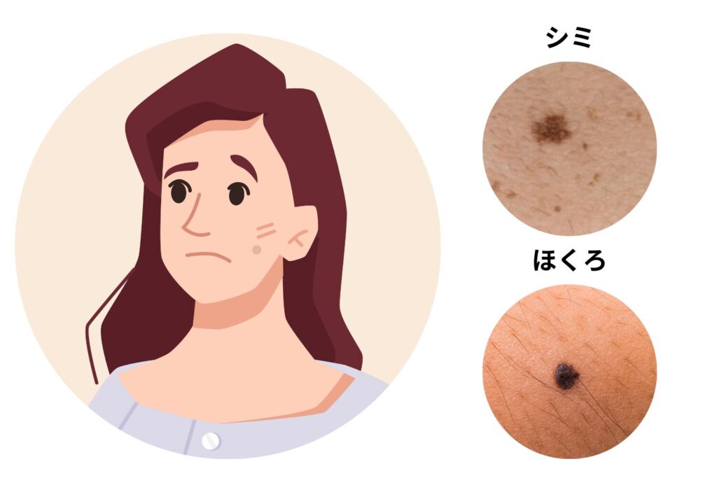 見た目が似ているため混同しやすい