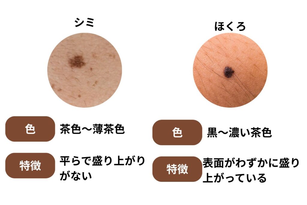見た目の特徴による違い