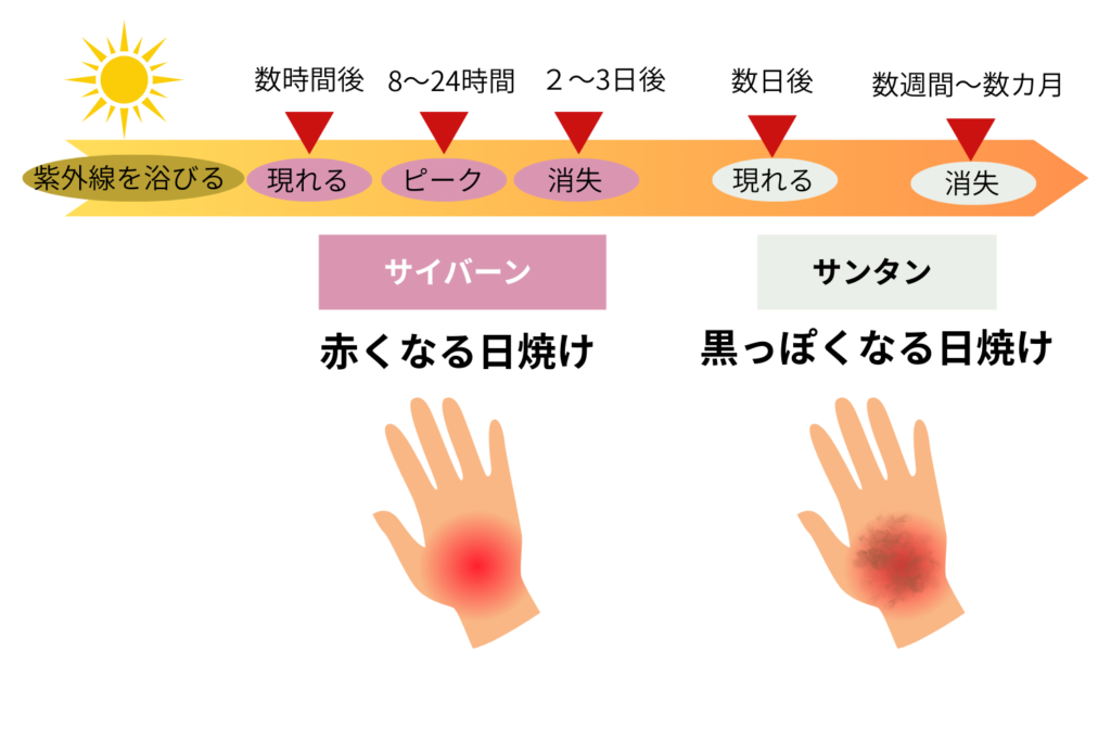 日焼け直後に起こる肌の変化
