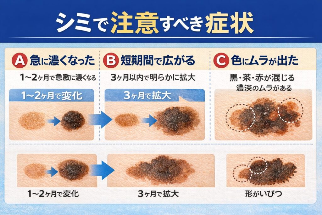 シミで注意すべき症状