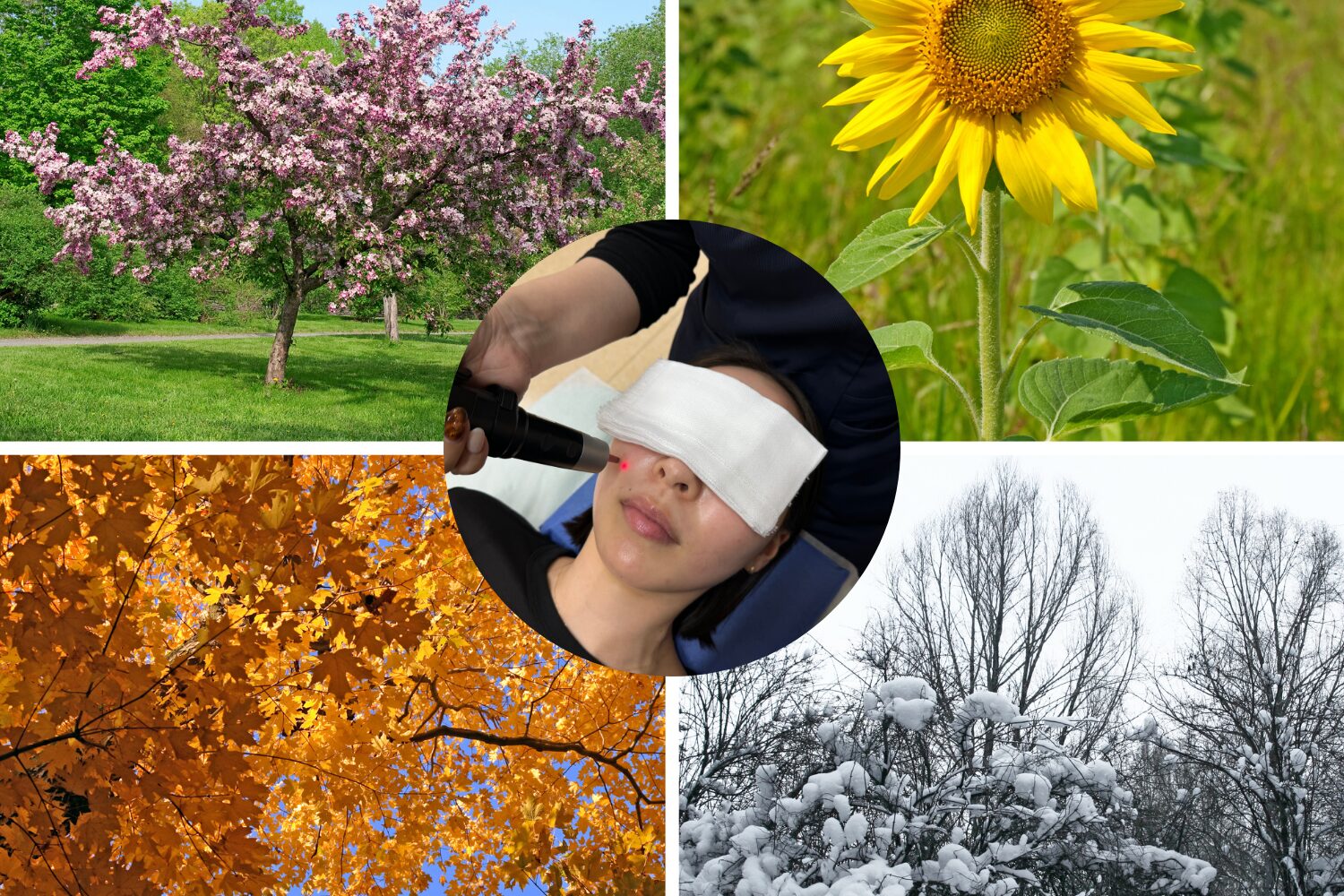 シミ取り治療の最適な時期は?季節別の注意点とおすすめ時期を解説