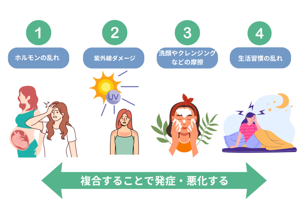肝斑の主な原因：女性ホルモン・紫外線・摩擦刺激・ストレス