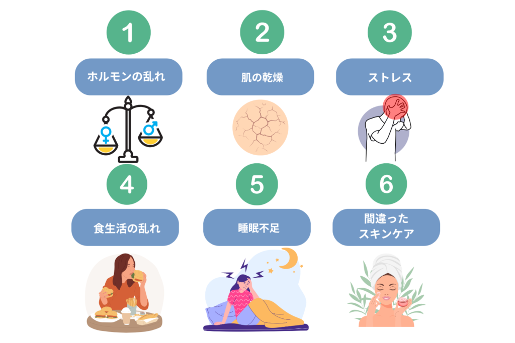 大人ニキビの原因とは?6つのポイント