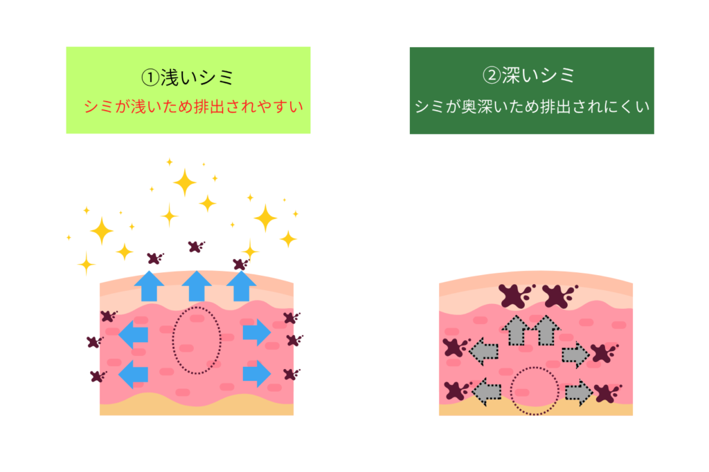 浅いシミと深いシミで異なる経過のパターン