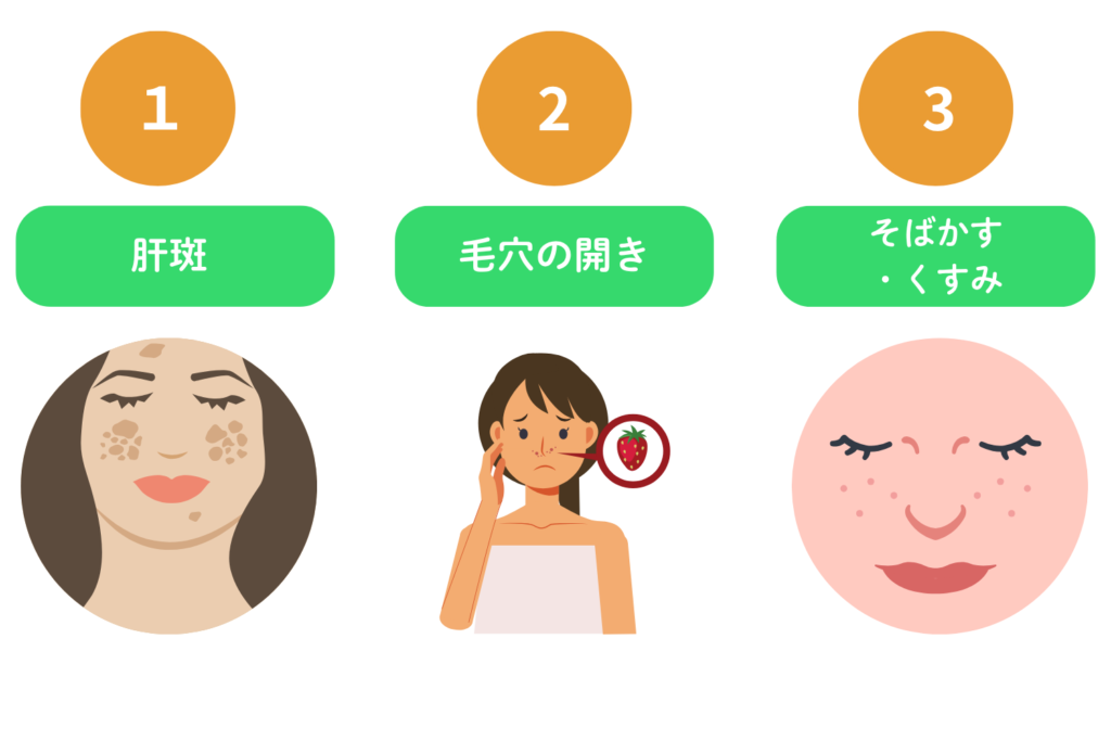 シミの種類別に見るピコレーザーの効果