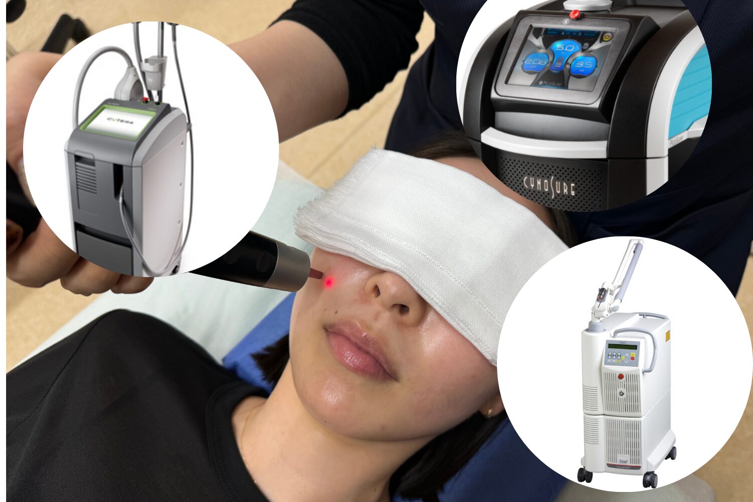 シミ取りレーザーの種類を徹底解説|効果・料金・ダウンタイム比較