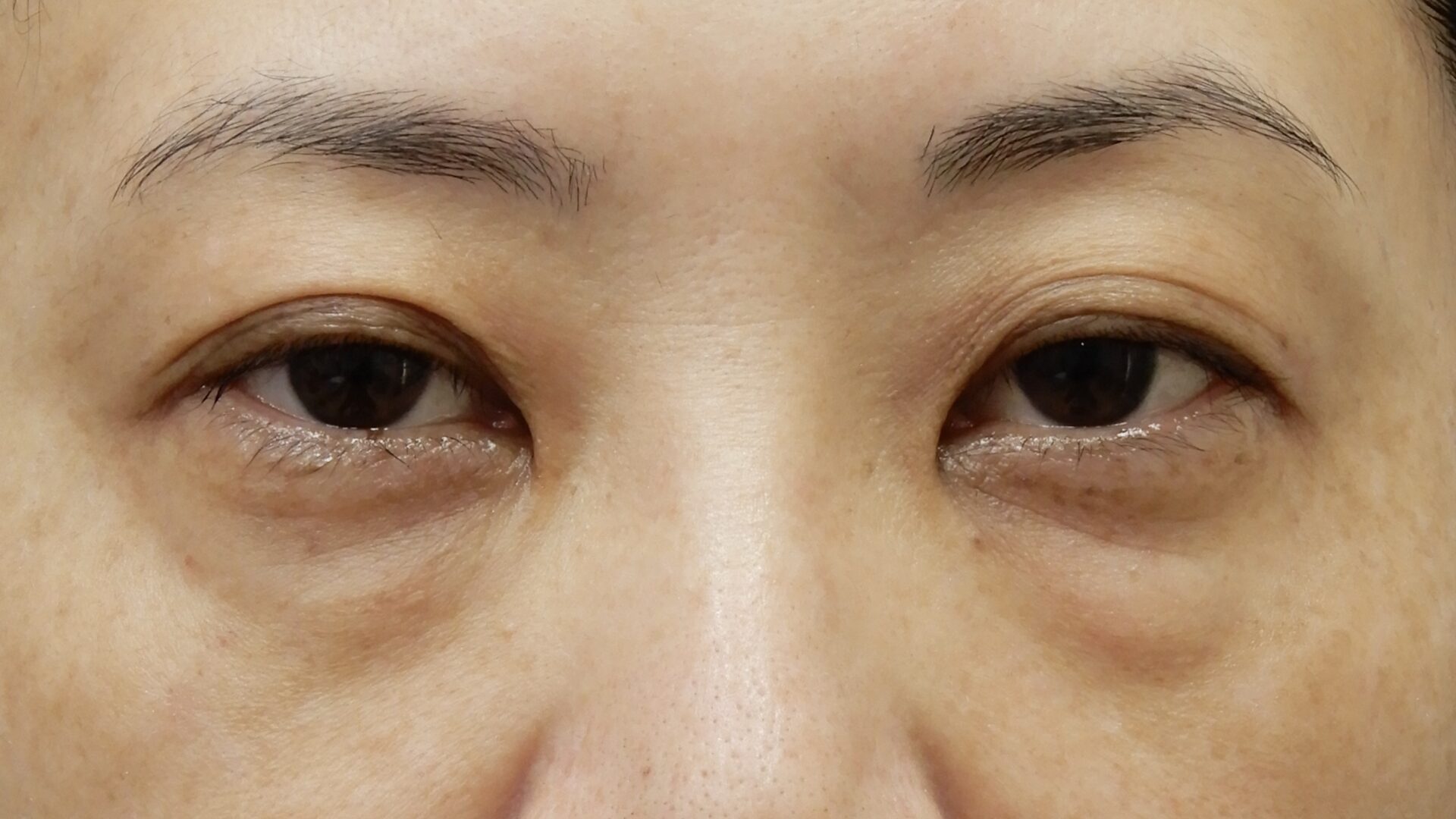 くまとりビフォー