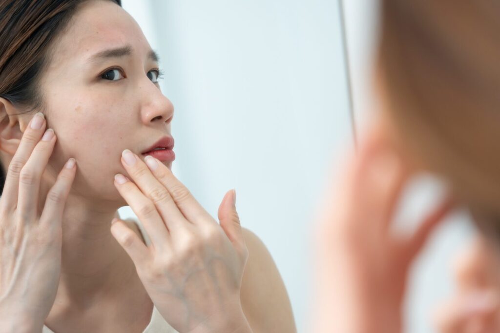 シミが盛り上がる原因とは？脂漏性角化症・日光角化症の見分け方...