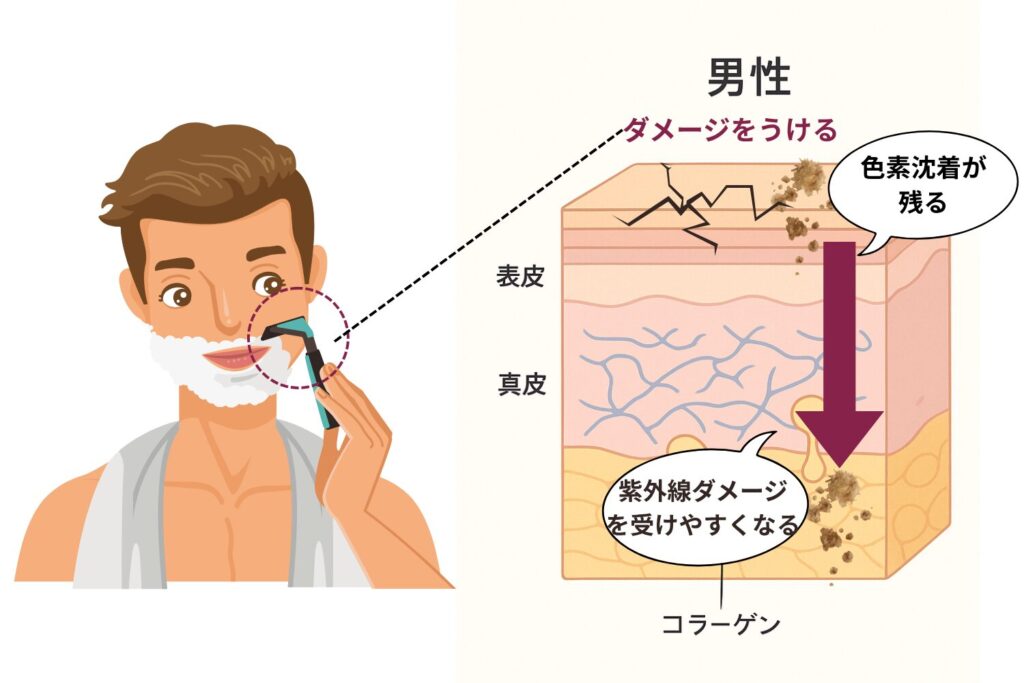 ヒゲ剃りや摩擦など日常的な刺激による炎症