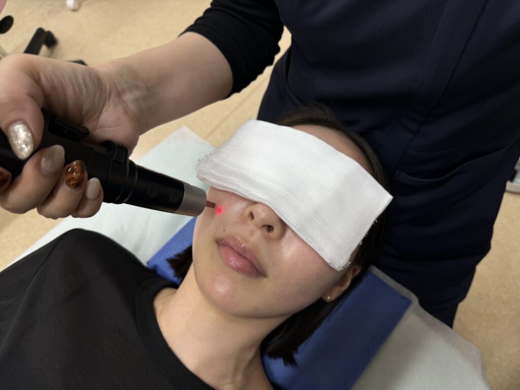 30代・40代のシミ治療