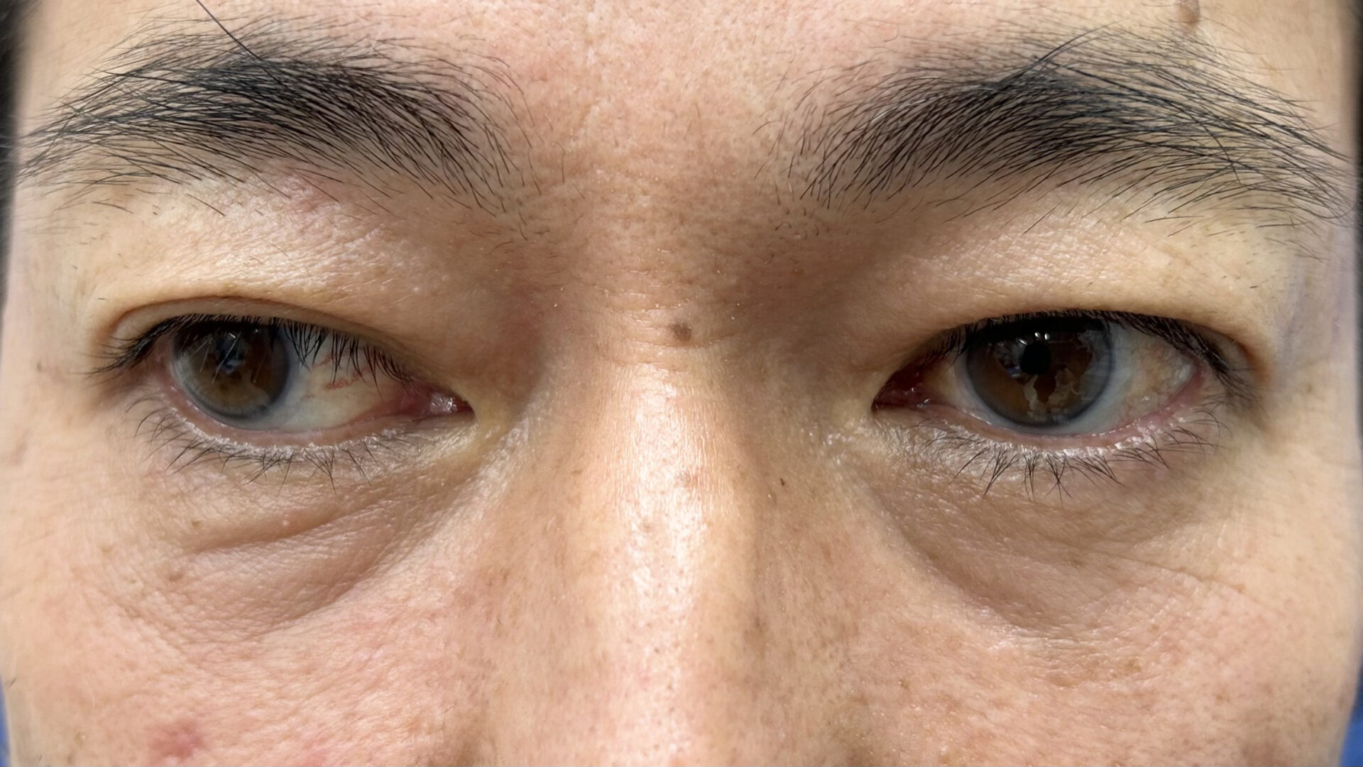 くまとりアフター