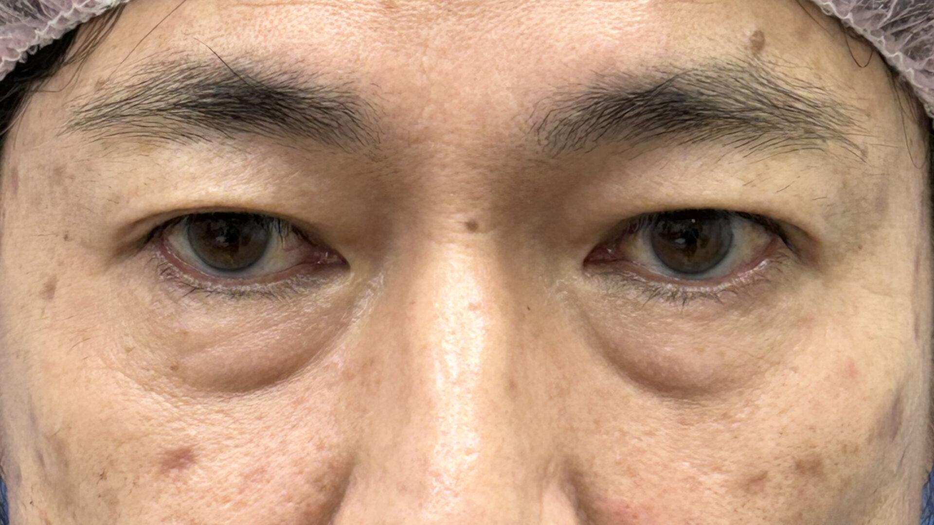 くまとりビフォー