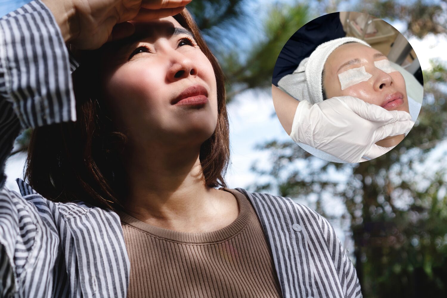 夏でもシミ取りはできる?紫外線対策で安心して始める美肌治療