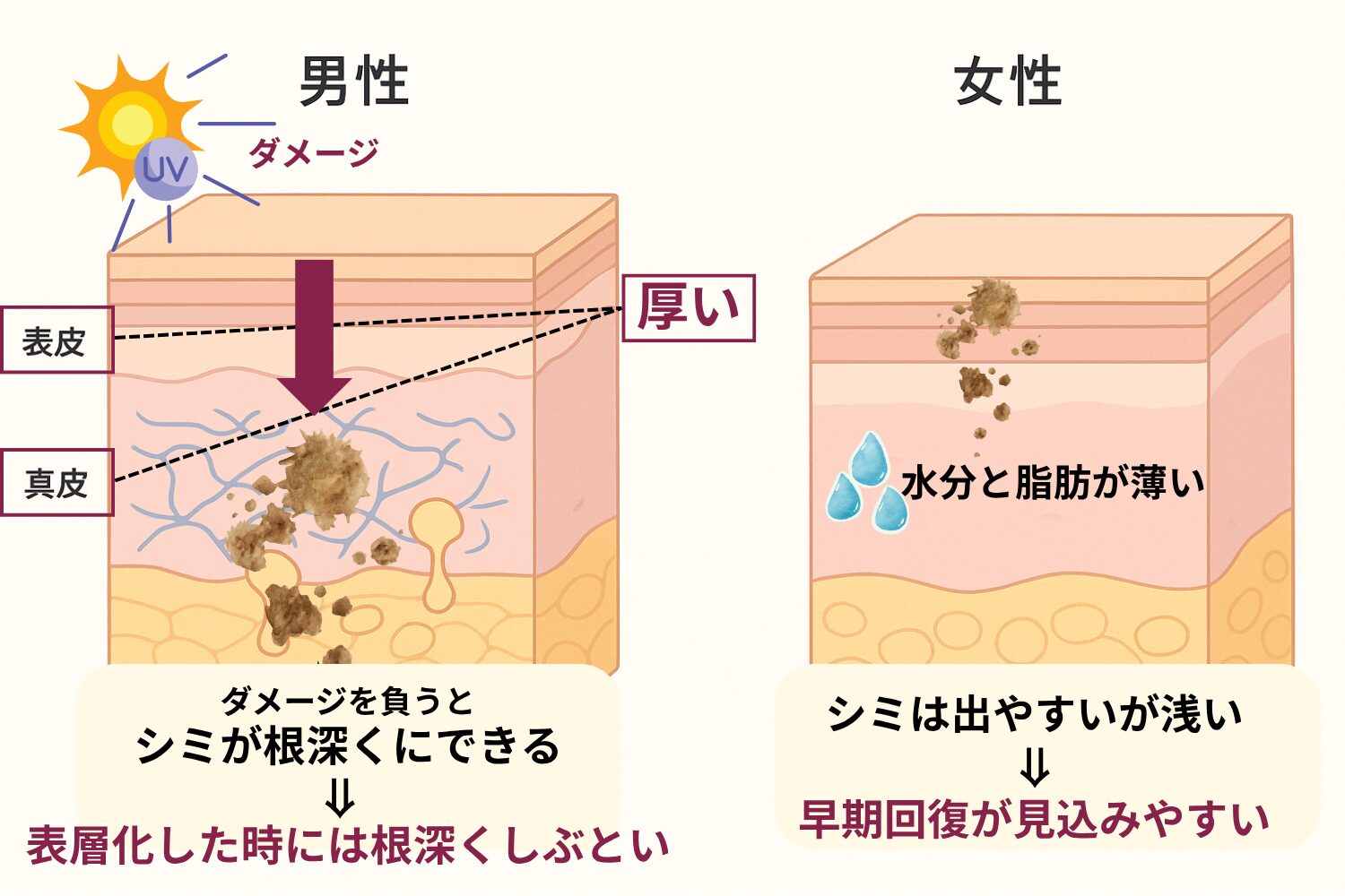 男性のシミは女性より濃く深い:肌の奥まで伸びるメラニン沈着