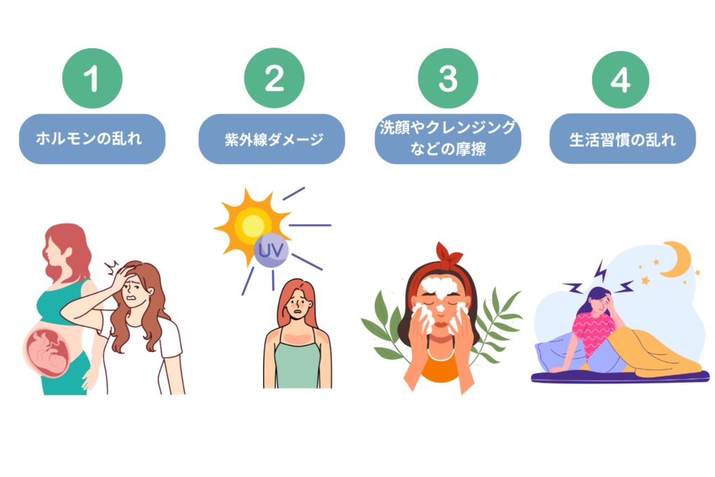 肝斑の主な原因：女性ホルモン・紫外線・摩擦刺激・ストレス