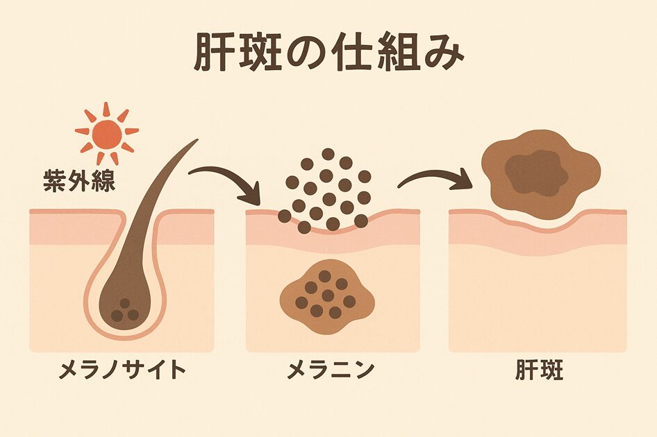 メラニン生成の仕組みと排出の滞り