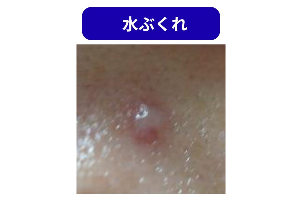医師に相談したほうがよい状態