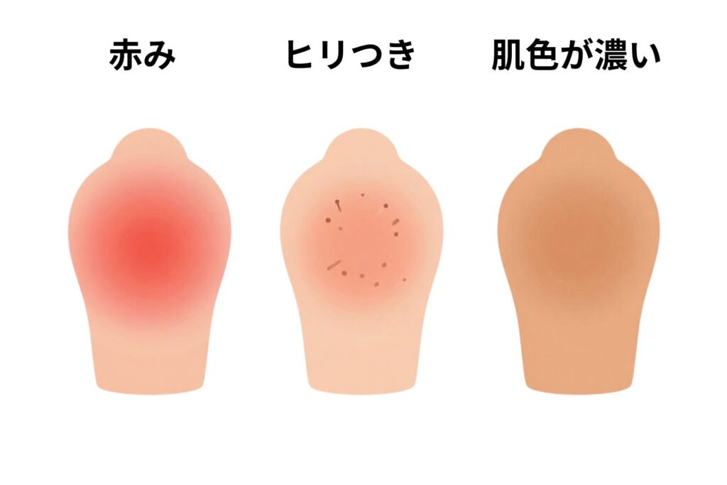 秋は夏の日焼けが残っていないか確認する