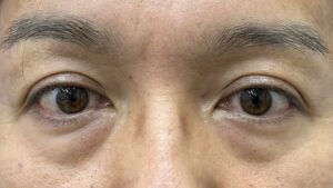 くまとり男性ビフォー