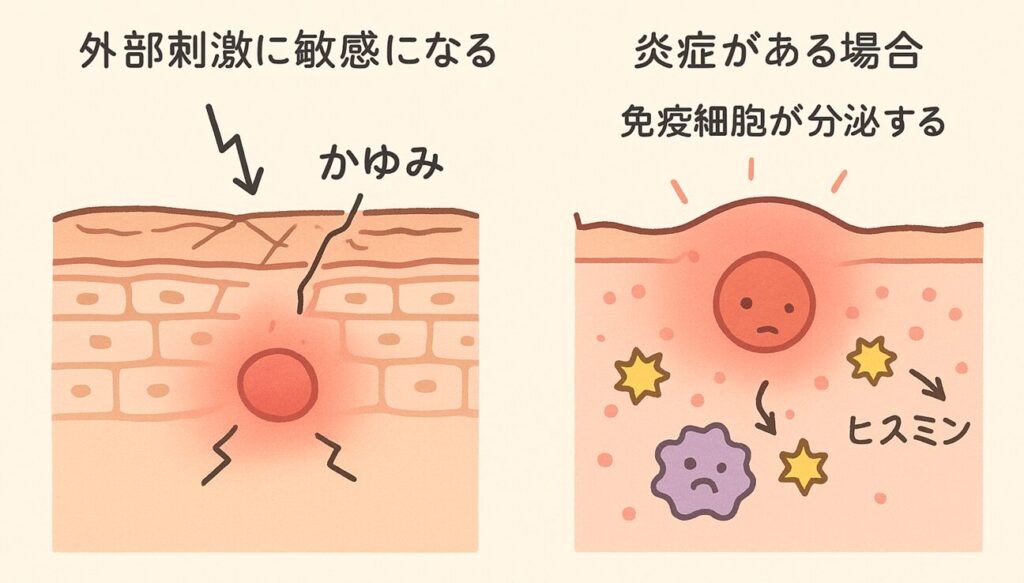 かゆいニキビは原因を見極めれば改善できる