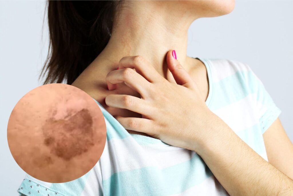 ただのシミ?かゆみが出た時の原因とチェックポイント