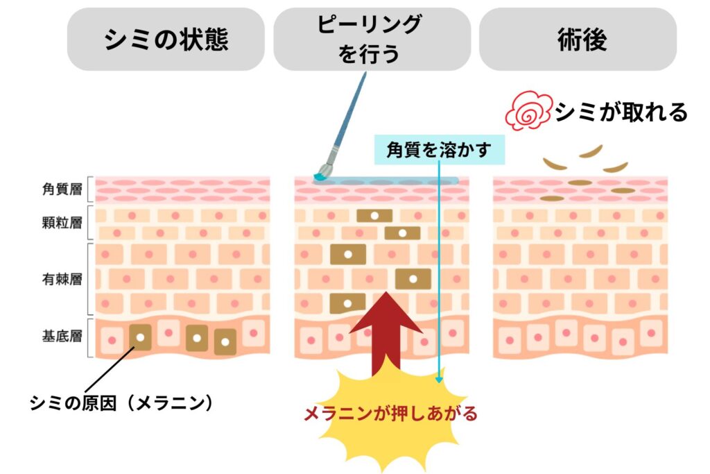 メラニンを排出する原理