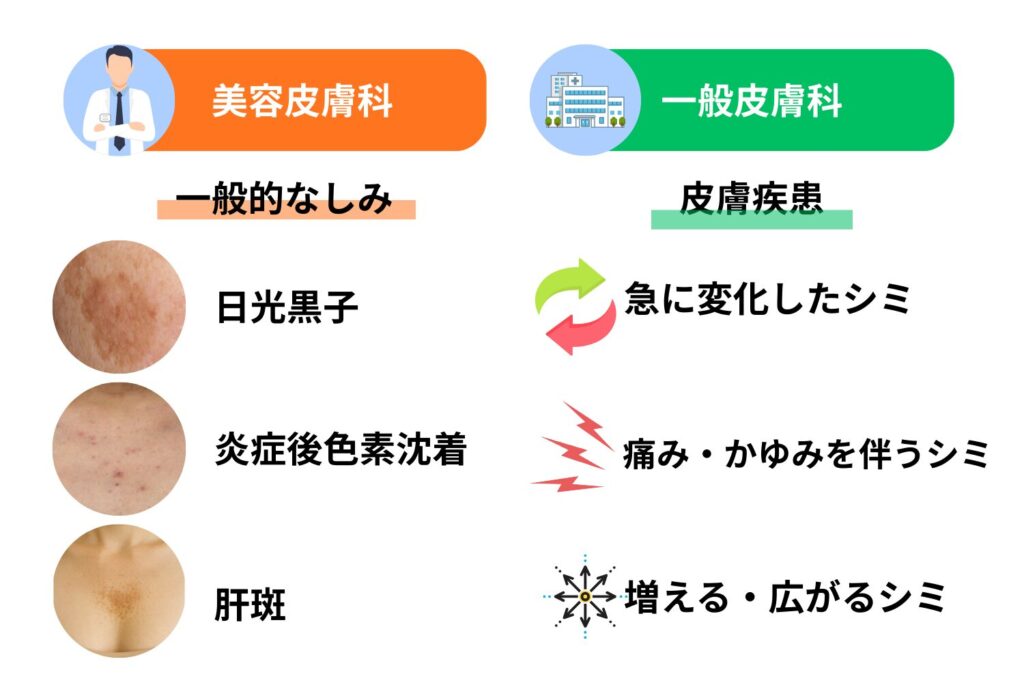 胸のシミの治療選択