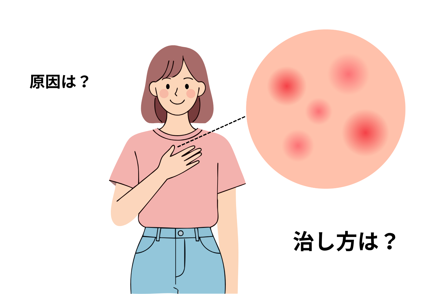 胸元のニキビはなぜできる?跡を残さず早く改善する方法