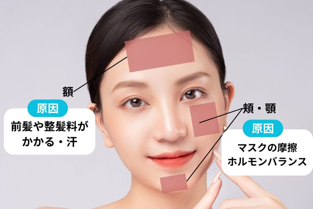 部位別で原因と対策を変える