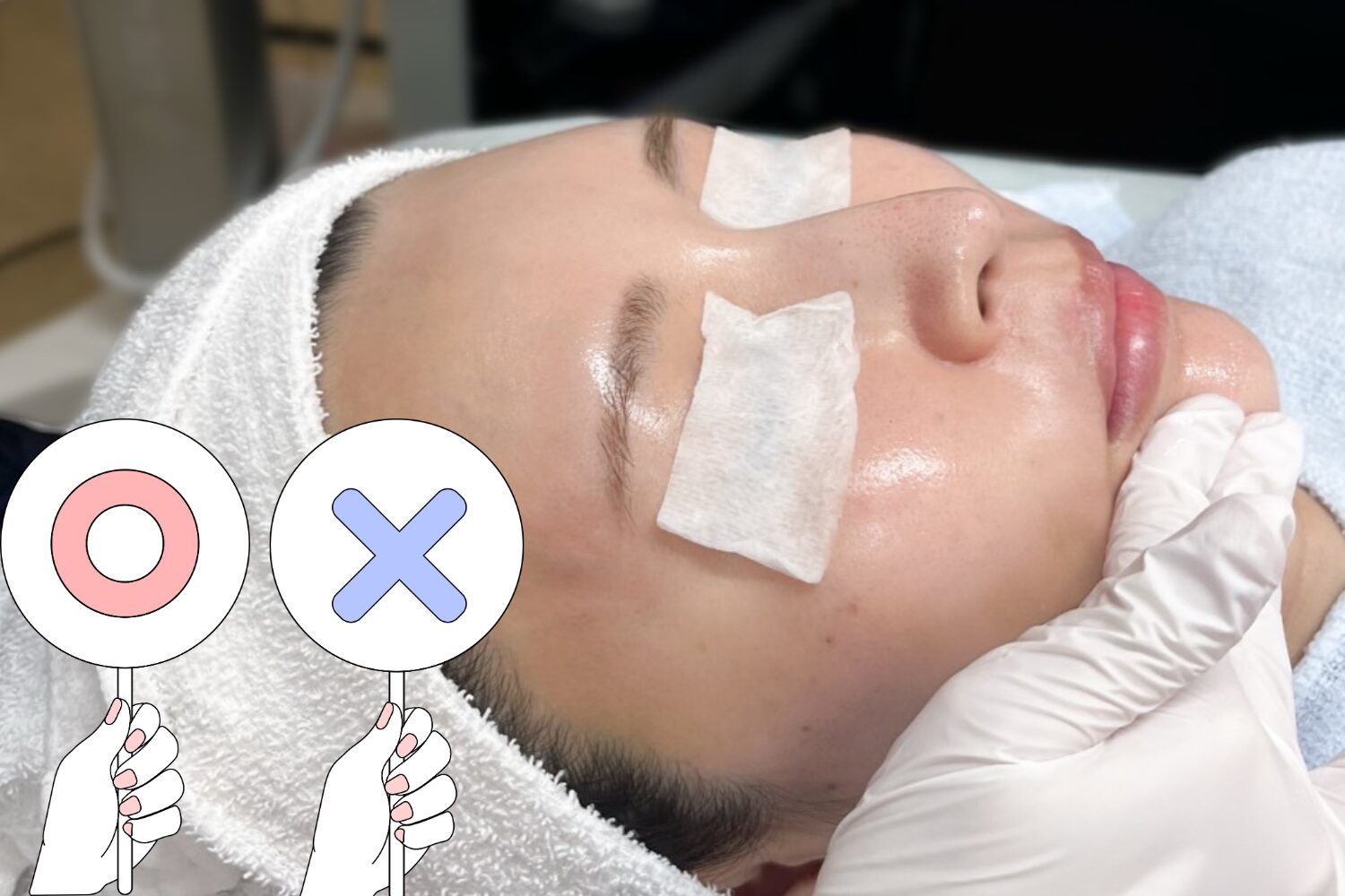 シミ取りにピーリングは効果的?原因別の最適治療と注意点を解説