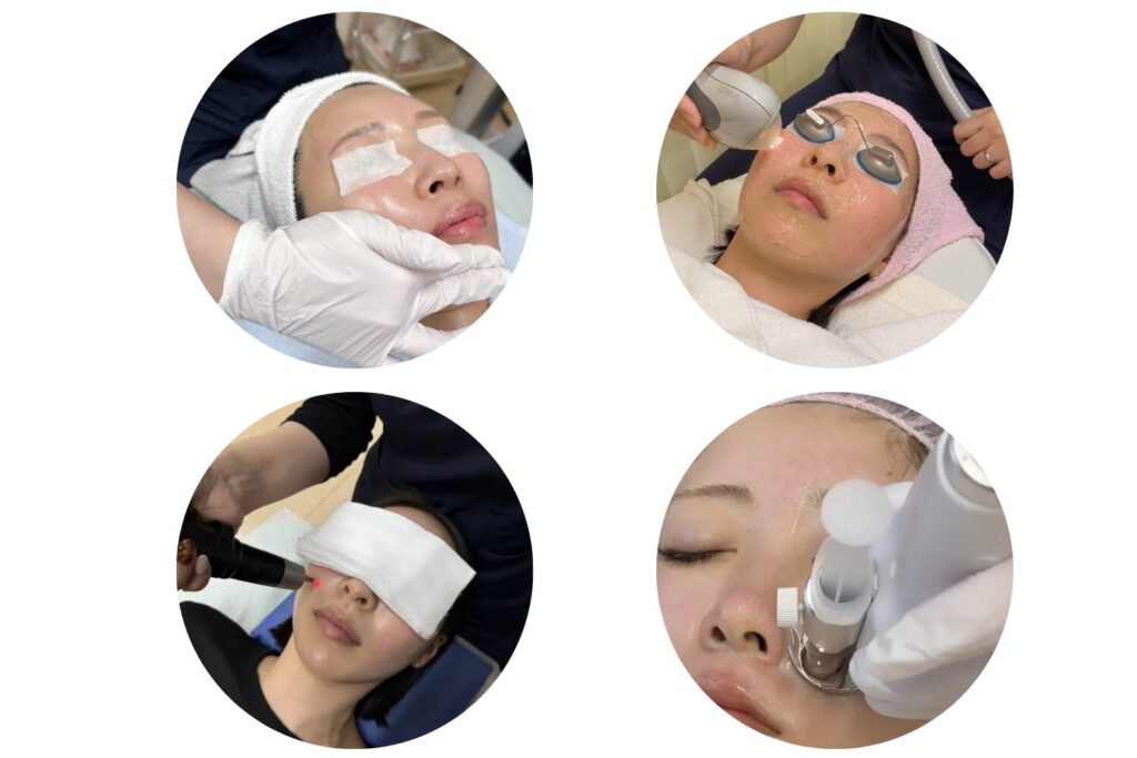 美容治療で早期治療