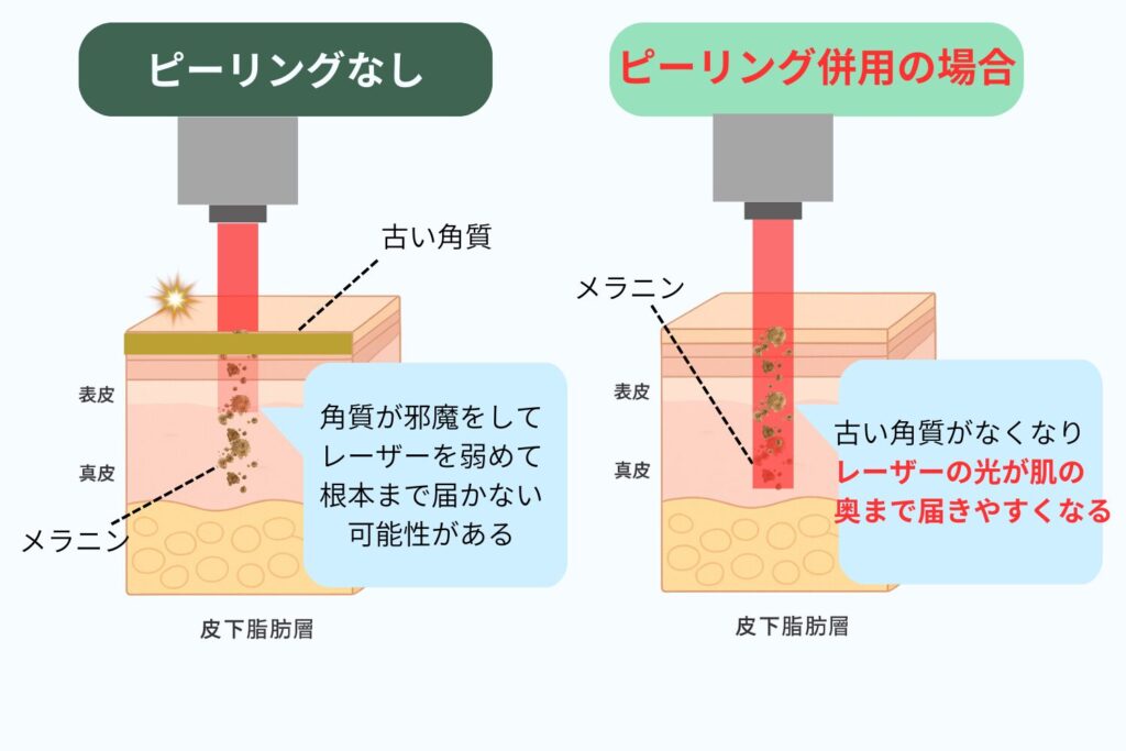光治療やレーザーの相乗効果