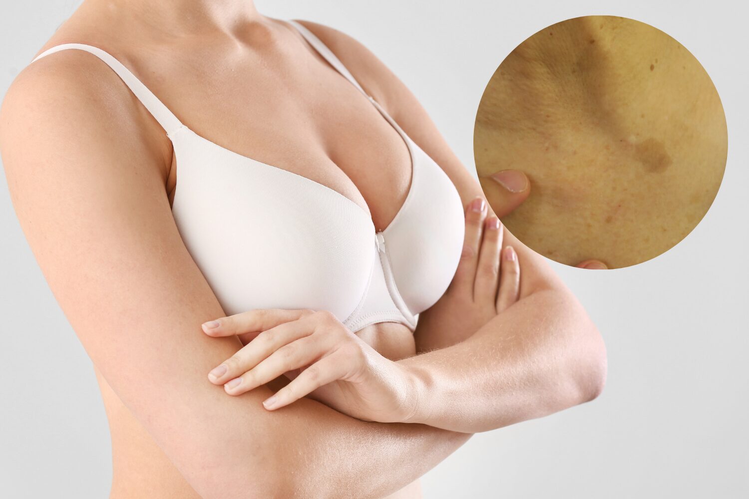 胸のシミ原因と正しい対策|種類別の見極め方と治療法ガイド