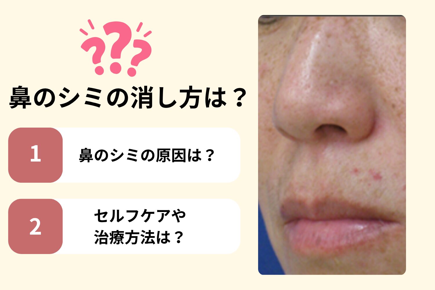 鼻のシミは原因特定で薄くできる|種類と消し方・最短治療法