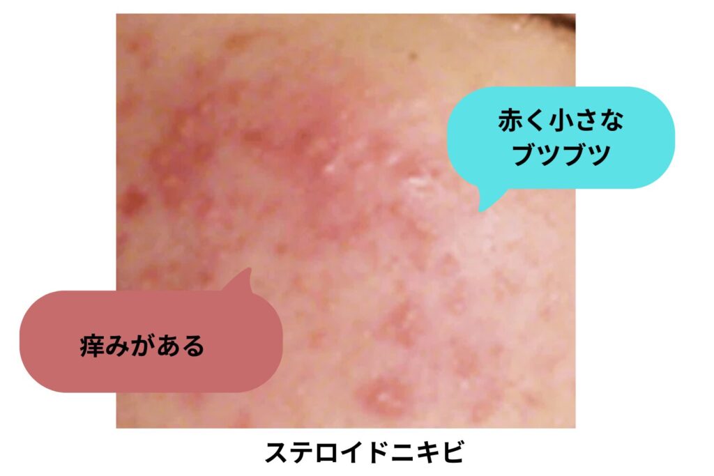 使用条件を誤ると悪化する