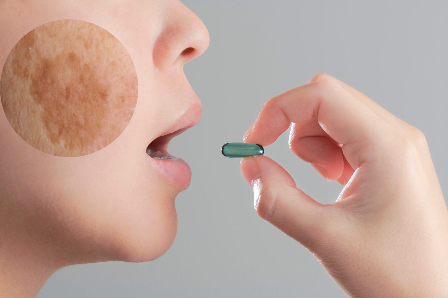 シミに効く内服薬|効果・種類・市販薬との違いを徹底解説