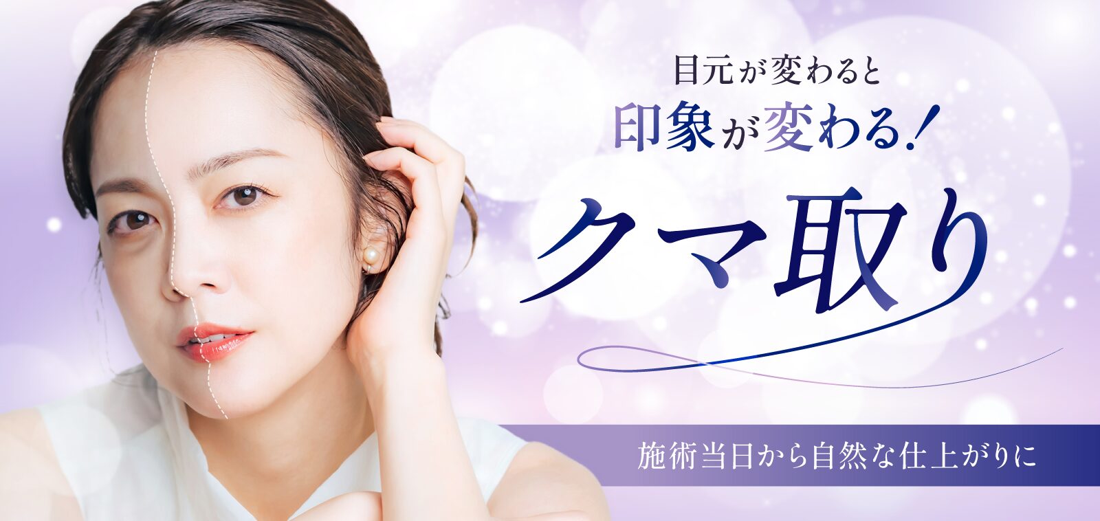 目の下のクマ・たるみとり