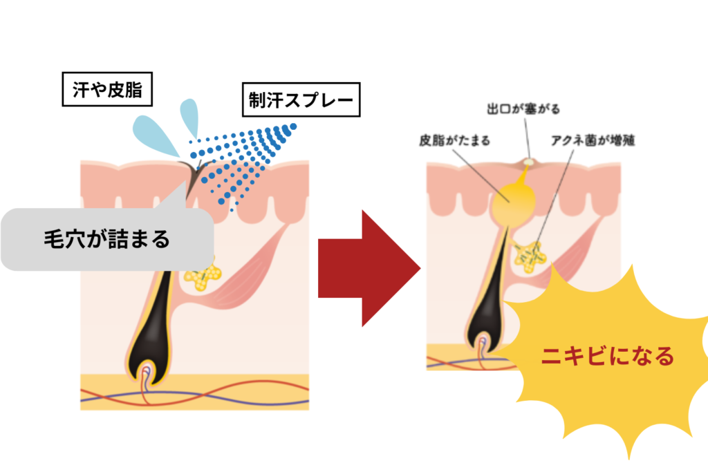 毛穴が詰まりやすい環境