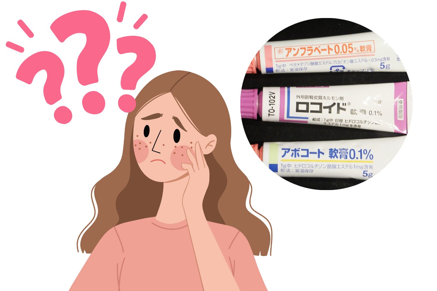 ステロイドでニキビは治る?悪化リスクと正しい使い方