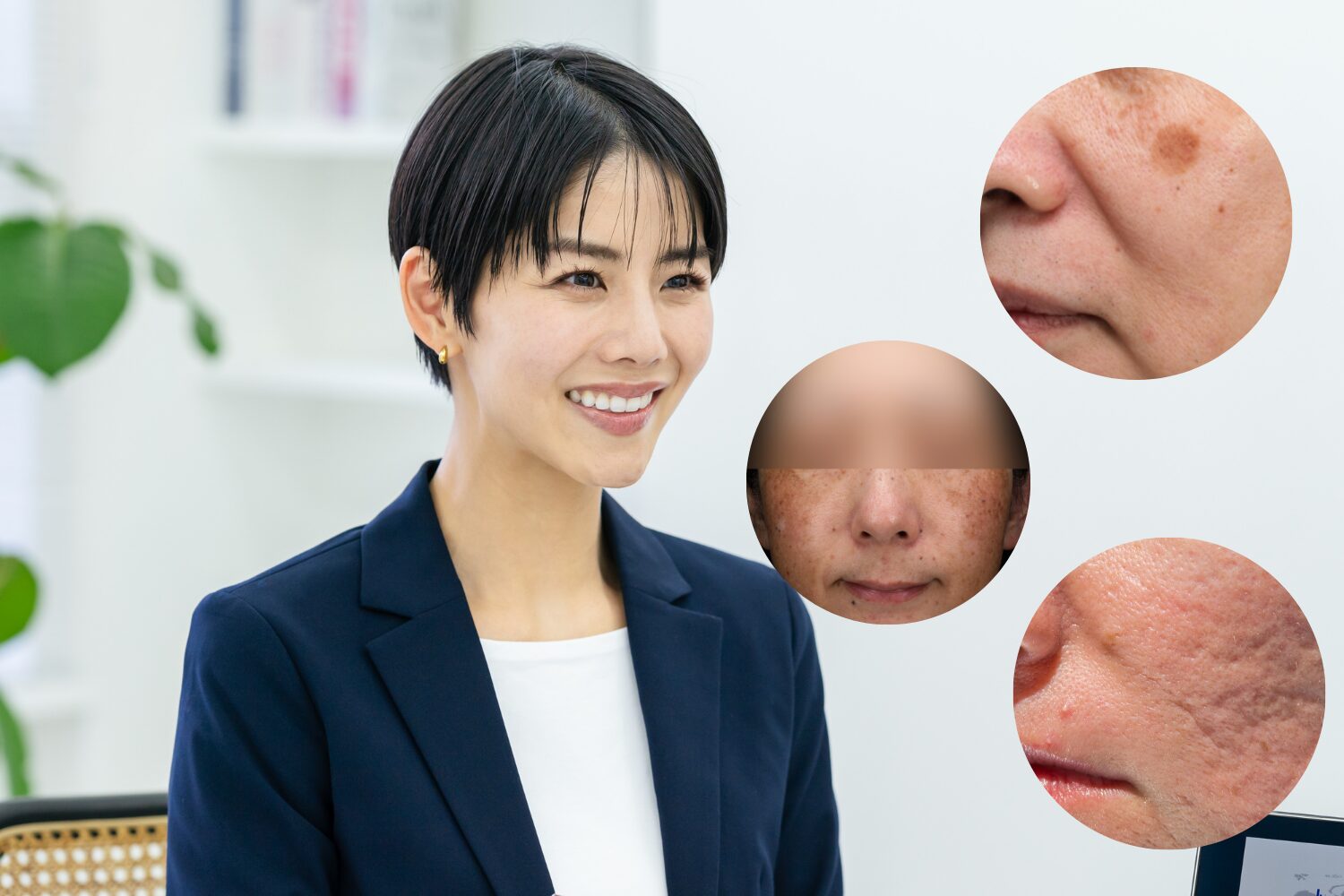 40代のシミ取り完全ガイド｜原因・種類・最適な治療法を解説