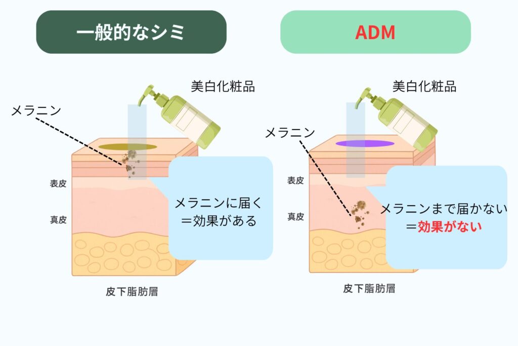 なぜ美白化粧品が効きにくいのか