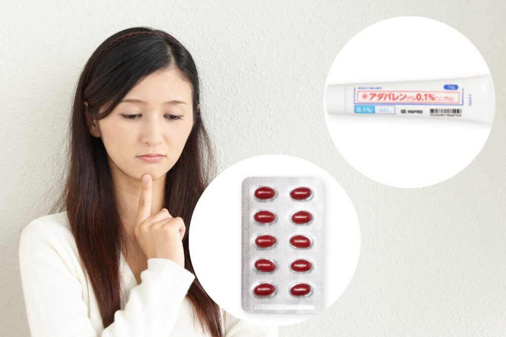 ニキビに抗生物質は効く？種類・効果・安全な使い方を徹底解説