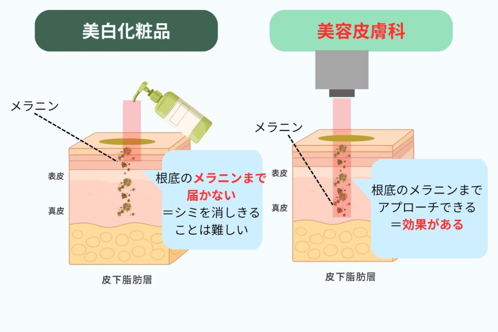 専門的な治療を選ぶ理由