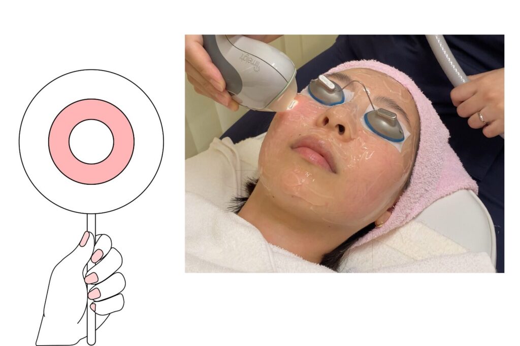 まぶたのシミは専門治療で安全に取れる？