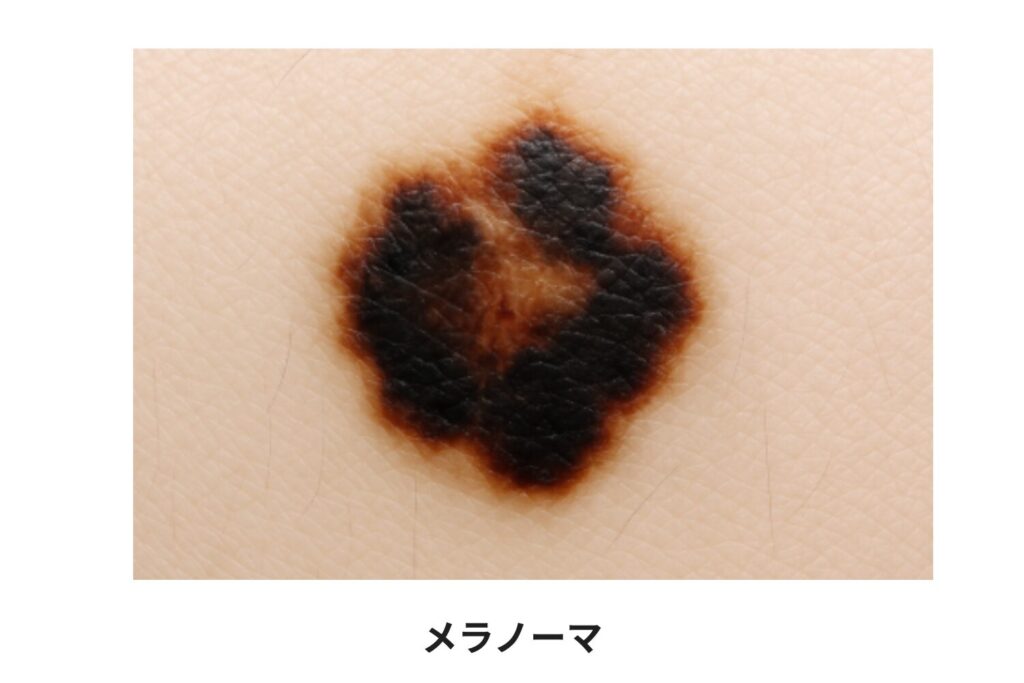 軽症から重大疾患まで幅広い