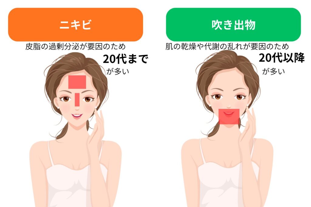 年代と肌環境で変わる呼び分け